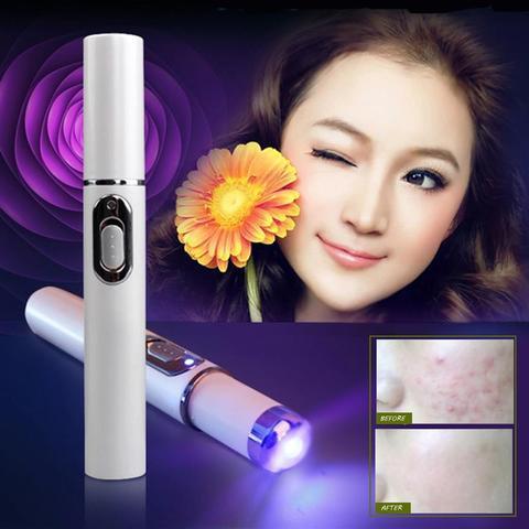 blue light therapy acne laser pen for scar treatment