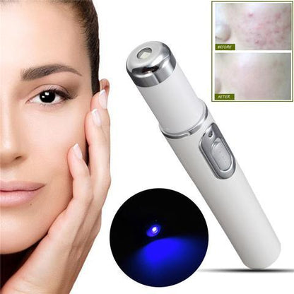 blue light therapy acne laser pen