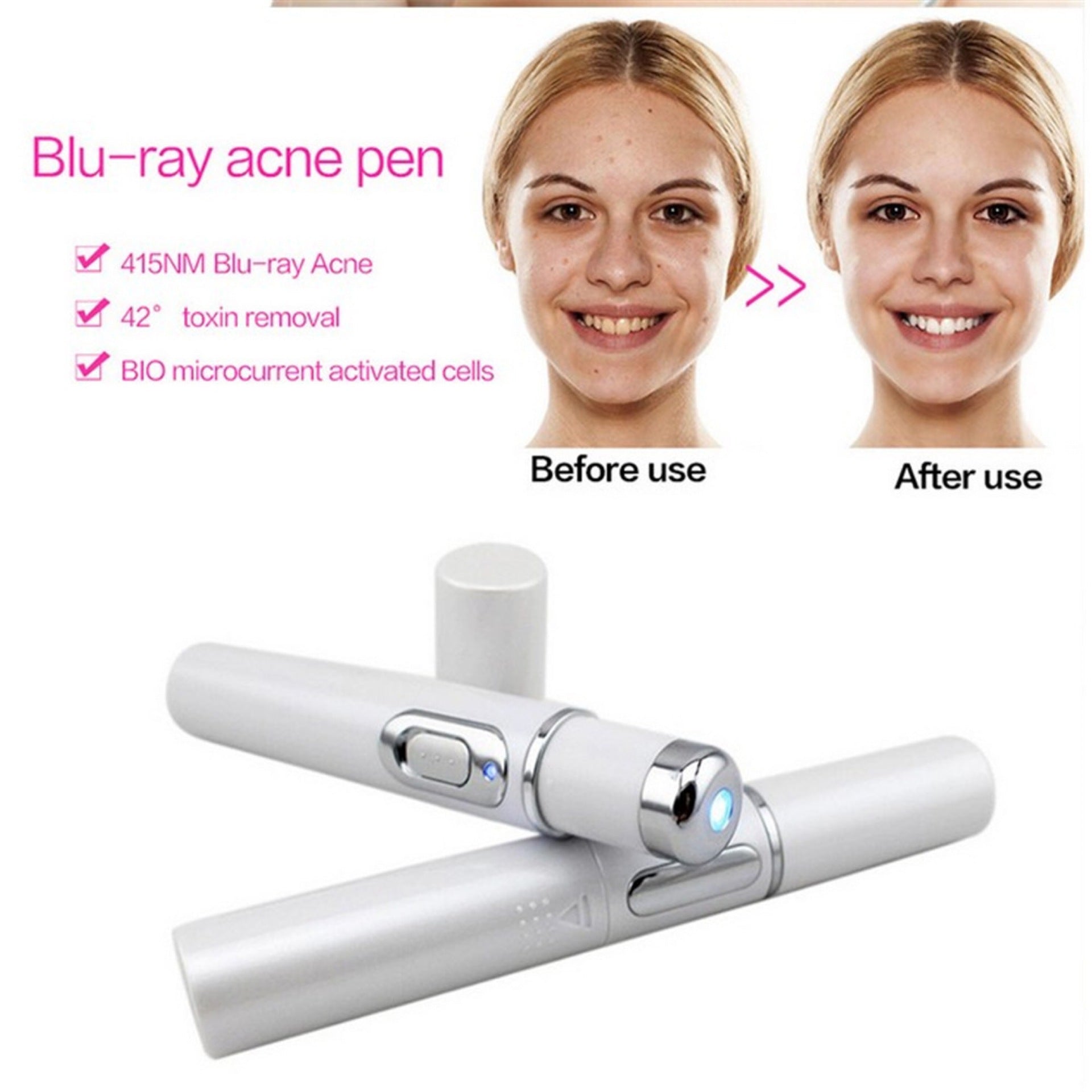 blue light therapy pen for scar treatment