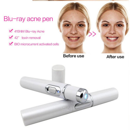 blue light therapy pen for scar treatment