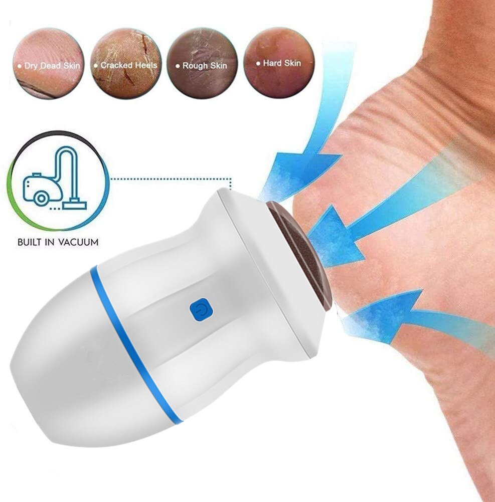 callus remover for feet