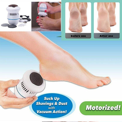 callus remover